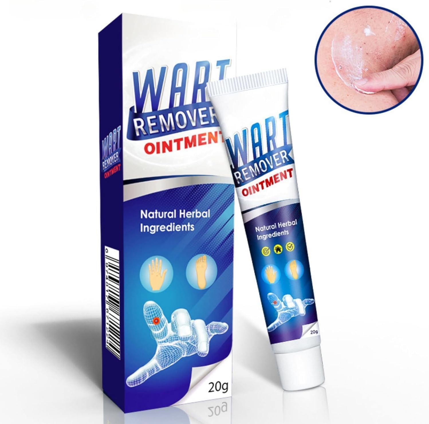 Warts Remover Ointment Wart Treatment Cream Skin