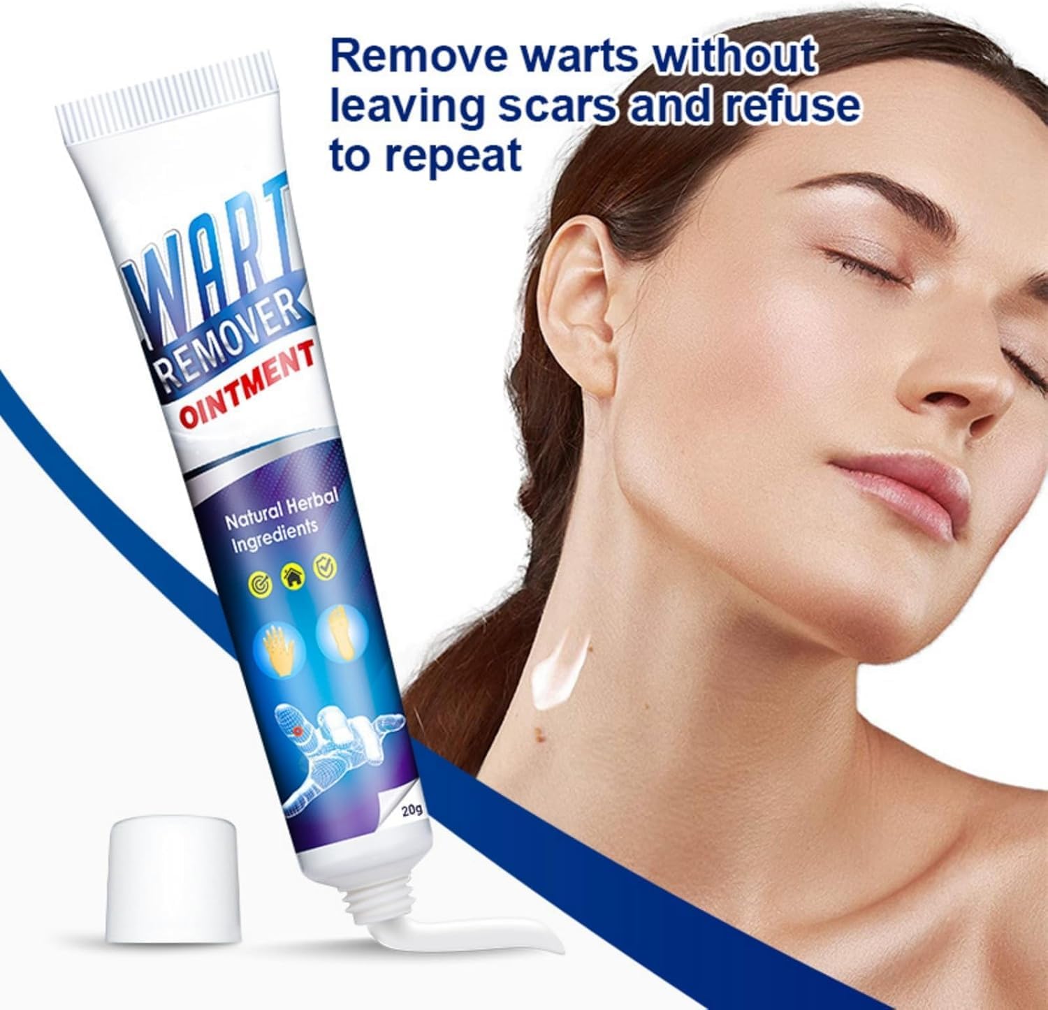 Warts Remover Ointment Wart Treatment Cream Skin